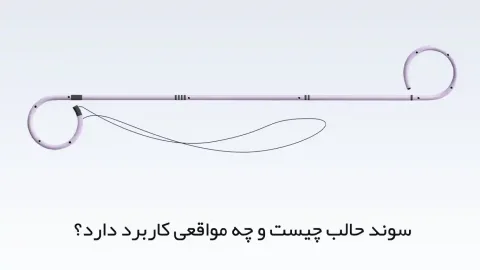 سوند حالب چیست و چه مواقعی کاربرد دارد؟