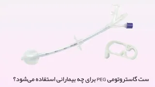 ست گاستروتومی PEG برای چه بیمارانی استفاده می‌شود؟