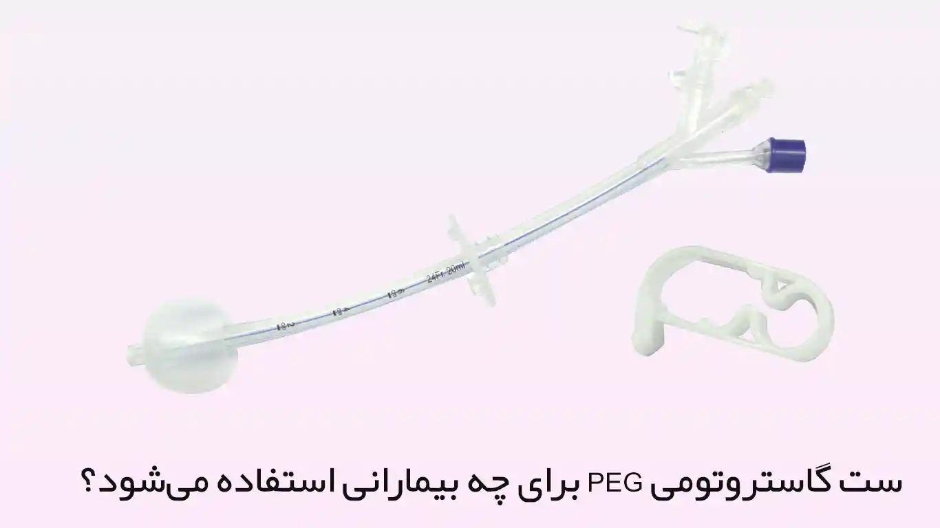 ست گاستروتومی PEG برای چه بیمارانی استفاده میشود؟