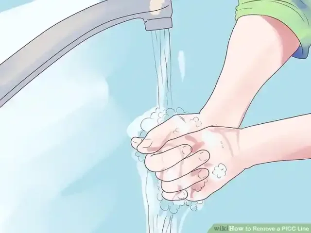 Image titled Remove a PICC Line Step 2