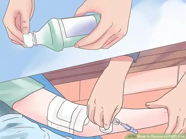 Image titled Remove a PICC Line Step 6