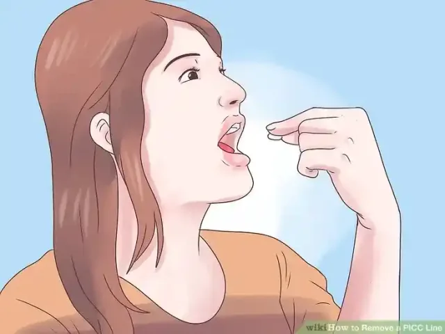 Image titled Remove a PICC Line Step 10