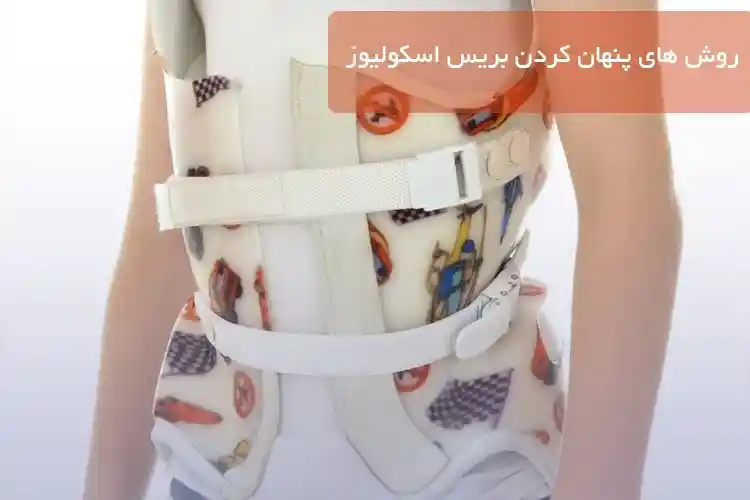 روش های پنهان کردن بریس اسکولیوز