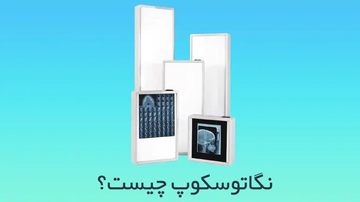 نگاتوسکوپ چیست ؟