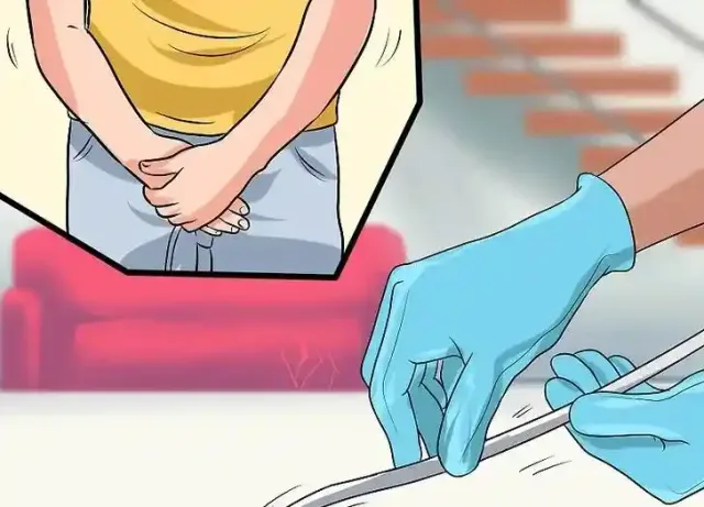 حال بعد از خارج کردن سوند