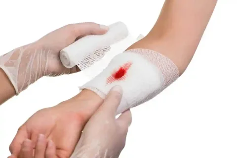 التیام و ترمیم زخم