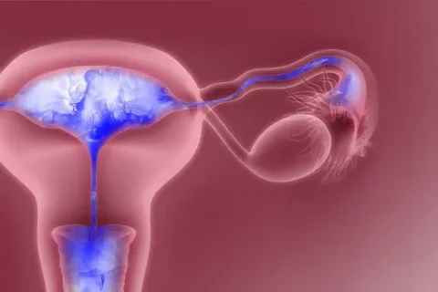 هیستروسالپنگوگرافی (Hysterosalpingography) چیست؟