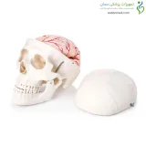 مولاژ جمجمه با نمایش مغز