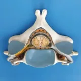 مولاژ مهره 5 گردن