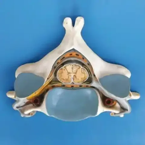 مولاژ مهره 5 گردن