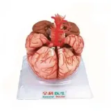 مولاژ مغز با نمایش عروق