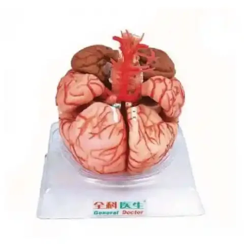 مولاژ مغز با نمایش عروق