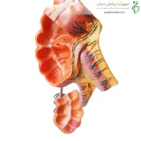 مولاژ آپاندیس و روده کور