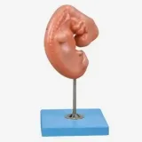 مولاژ جنین یک ماهه