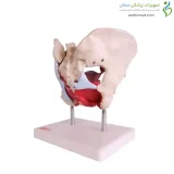 مولاژ لگن و رحم