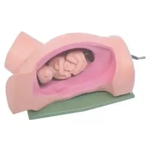 مولاژ زایمان مکانیکی + چرخش نوزاد