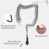 سوزن تزریق آندوسکوپی MEDWORK