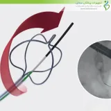 بسکت خروج سنگ Medwork