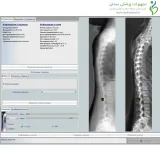 دستگاه سنجش تراکم استخوان Stratos Dr