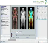 دستگاه سنجش تراکم استخوان Stratos Dr