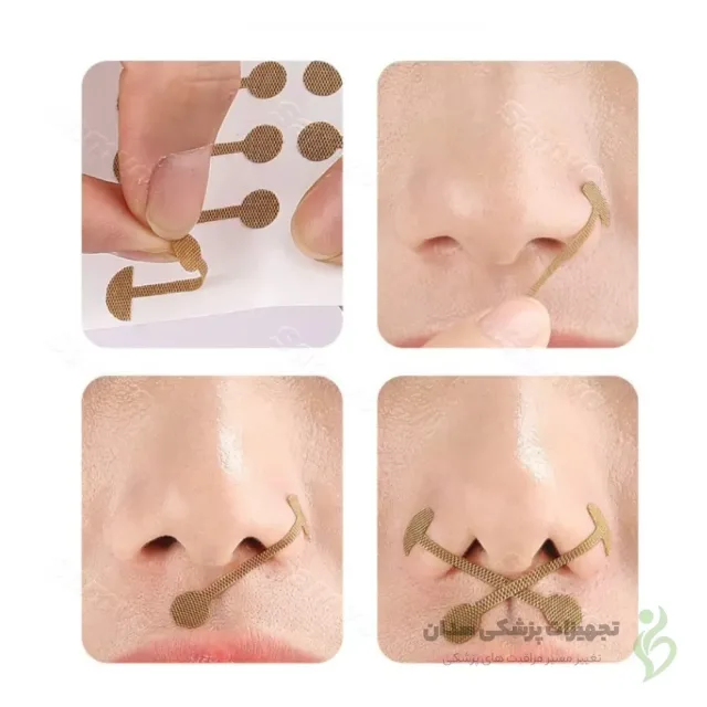 نحوه استفاده از چسب لیفت بینی