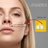 نحوه سایزبندی نوزونت تیوپی