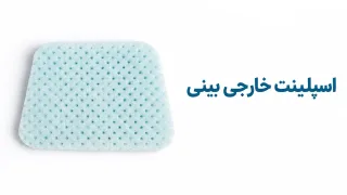 اسپلینت خارجی بینی ذوزنقه‌ای؛ مدل‌های کلاریتی و GMB و راهنمای خرید