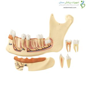 Alternative view of مولاژ آرواره پایین تا 18 سال