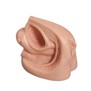 سوند گذاری زن