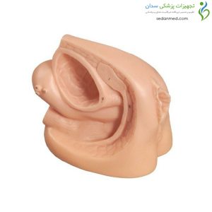 Alternative view of سوند گذاری زن