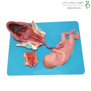 Alternative view of مولاژ مراحل زایمان