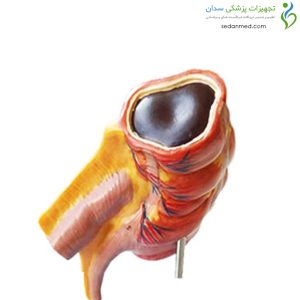 Alternative view of مولاژ آپاندیس و روده کور