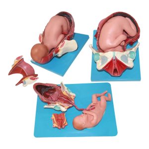 مولاژ مراحل زایمان