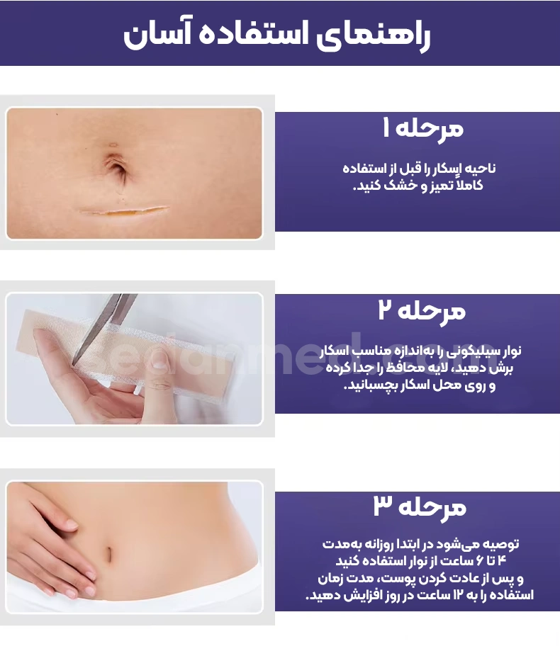 راهنمای استفاده از چسب سیلیکون شیت زخم