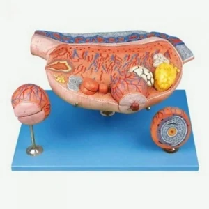 مولاژ تخمدان