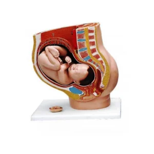 مولاژ لگن رحم در نهمین ماه بارداری