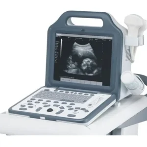 دستگاه سونوگرافی پرتابل N5