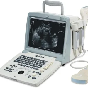 دستگاه سونوگرافی پرتابل Full Digital مدل Emp 820 Plus