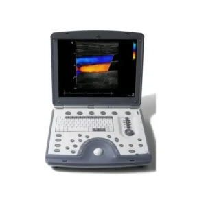 Alternative view of اکو GE مدل VIVID I