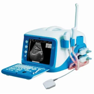 سونوگرافی ژوهو ZUXHOU) CX6000)