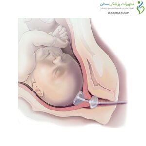 بالن رایپنینگ کوک مدیکال (Cook medical)