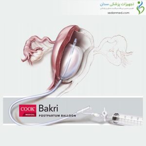 بالن بکری کوک مدیکال (Cook medical)