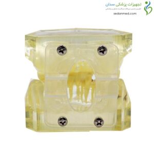 مولاژ دندان مدل ارتودنسی و درمان مالوکلوژن با براکت و کش‌های لیگاتور