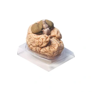 مولاژ مغز دو قسمتی