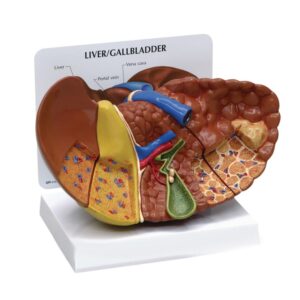 مولاژ پاتولوژی کبد