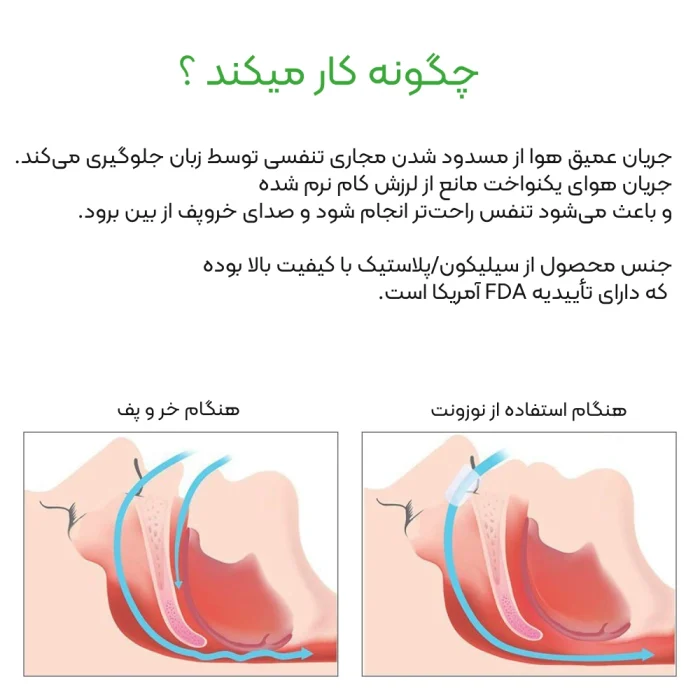نوزونت | گشادکننده بینی ضد خروپف و کمک‌تنفسی شبانه